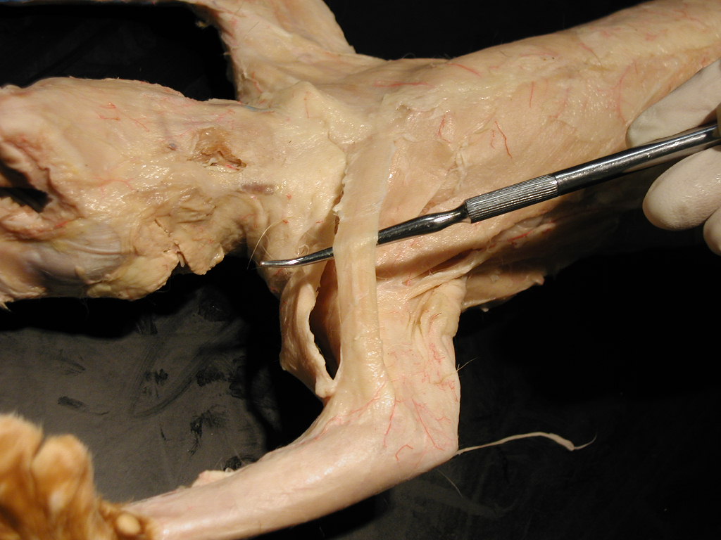 Pectoantebrachialis - Flashcard