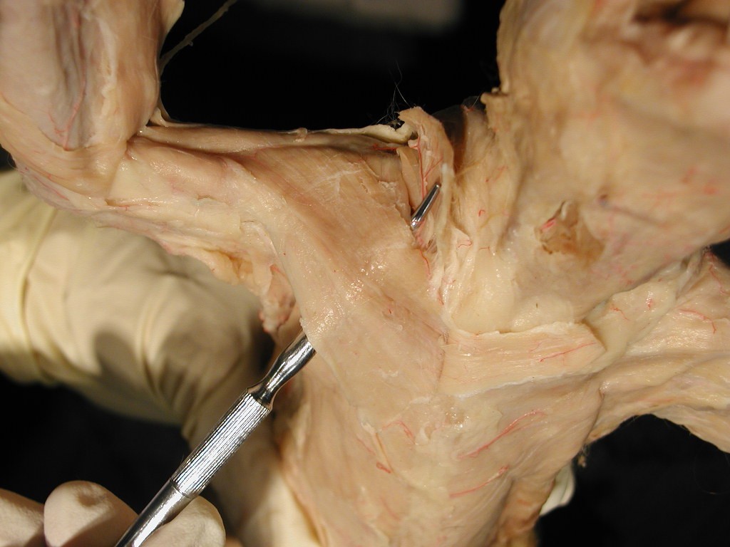 Pectoralis Major - Flashcard