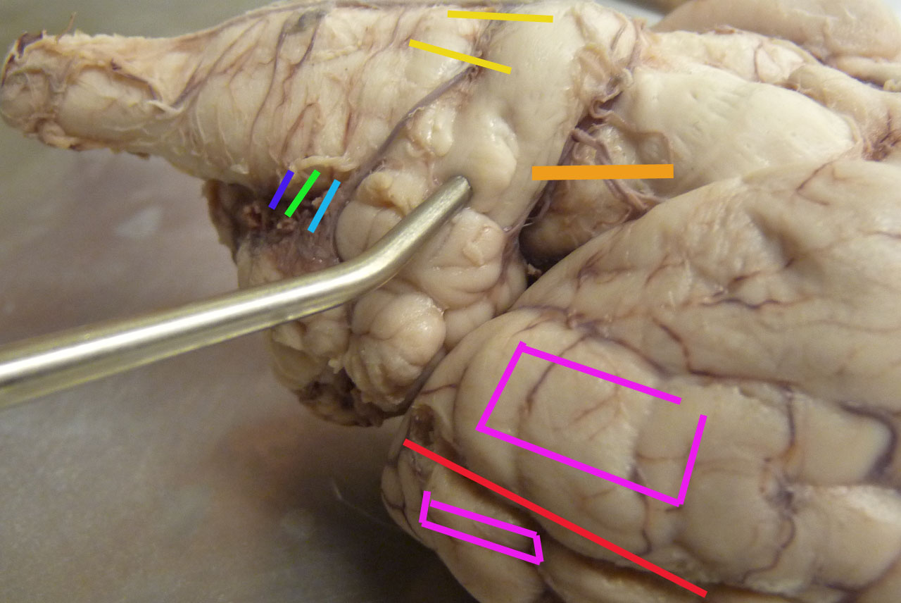 Sheep Brain Picsq - Flashcards