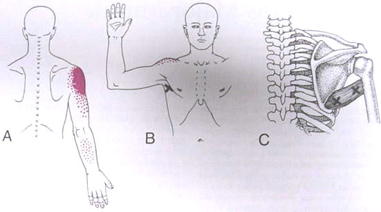 Question 11