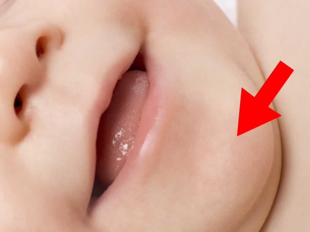 Chin - Flashcard