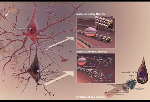 Pathogenesis Of AD  - Flashcard