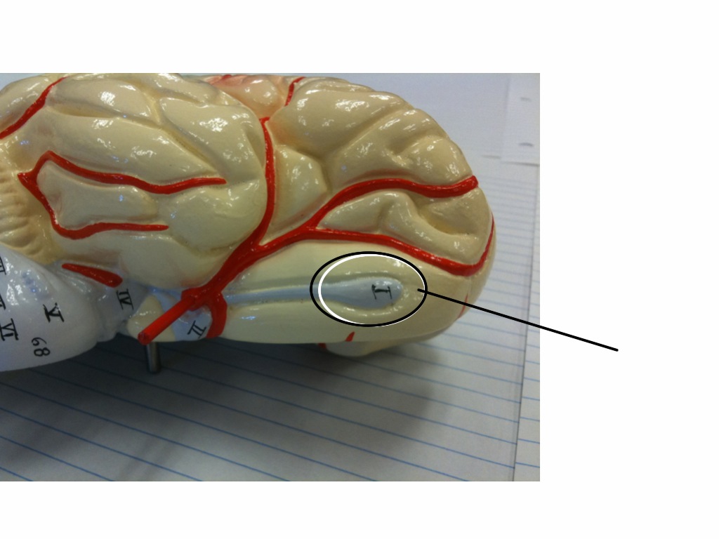 Fred's Bio 201 Nervous System Flashcards:  Three Lobes and a Baby - Flashcards