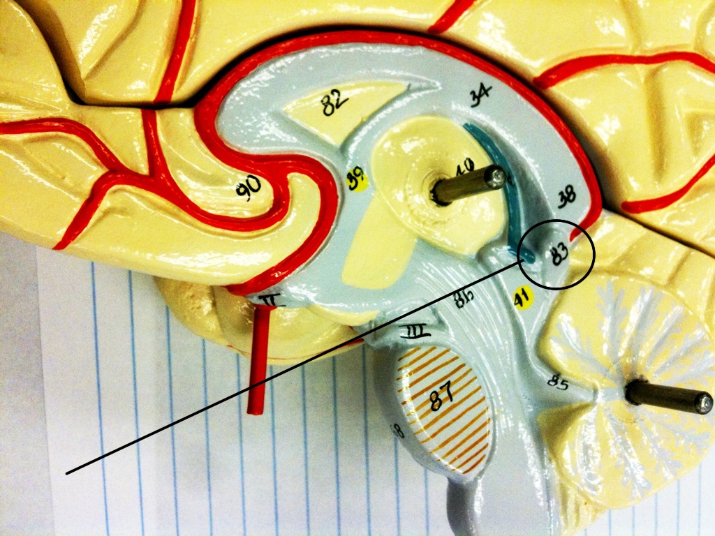 Name This Structure:  (just Superior To ... - Flashcard