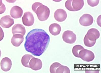 How Well Can You Identify These Hematology and Clinical Microscopy Flashcards - Flashcards