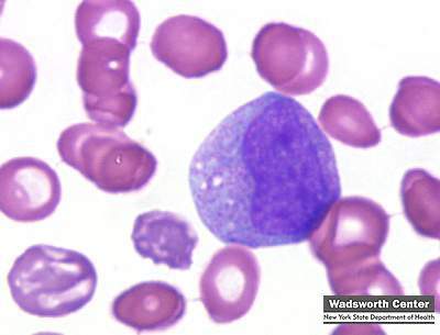 ID This Cell; What Is Diff About The Nucleus?... - Flashcard