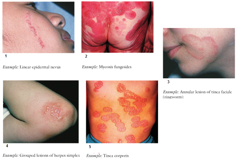 Health Assessment 1: Skin, Hair And Nails - Quiz
