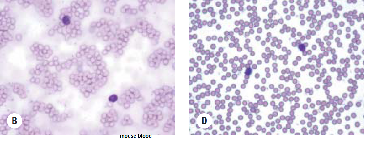 Whose Blood Is This? - Flashcard